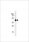 DANRE irf2bp2a Antibody (Center)